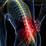 pain-management-in-bangalore (12)
