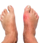 pain-management-in-bangalore (9)